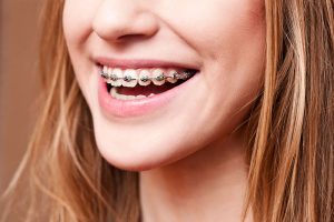 بهترین ارتودنسی در یزد