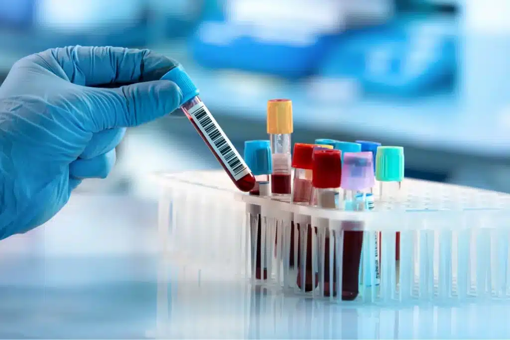 ازمایشگاه بوعلی یکی از معتبرترین ازمایشگاهای یزد