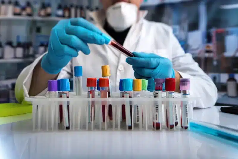 آزمایشگاه پارس مورد اعتماد ترین ازمایشگاه های یزد